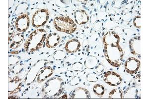 Immunohistochemical staining of paraffin-embedded Human thyroid tissue using anti-USP5 mouse monoclonal antibody. (USP5 antibody)