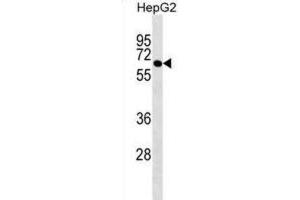 Western Blotting (WB) image for anti-Polypyrimidine Tract Binding Protein 3 (PTBP3) antibody (ABIN2999678) (PTBP3 antibody)