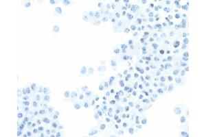 Immunohistochemical staining of SV40 large T, small t antigen. (SV40 Large T and Small Ts antibody)