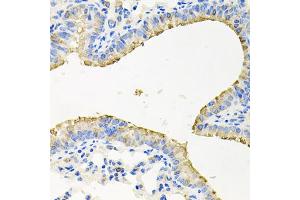 Immunohistochemistry of paraffin-embedded mouse lung using STRN3 antibody (ABIN5974086) at dilution of 1/100 (40x lens). (STRN3 antibody)