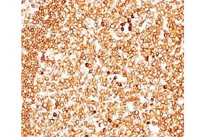 IHC testing of human tonsil (10X) stained with CD79a antibody cocktail (JCB117 + HM47/A9). (CD79a antibody  (AA 202-216))