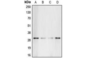 Western blot analysis of C1QBP expression in HeLa (A), HepG2 (B), Raji (C), K562 (D) whole cell lysates. (C1QBP antibody  (Center))