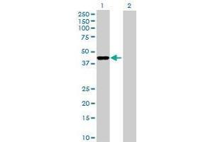 Lane 1: MARVELD3 transfected lysate ( 44. (MARVELD3 293T Cell Transient Overexpression Lysate(Denatured))