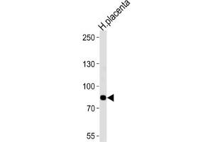 Western Blotting (WB) image for anti-Adenosine Monophosphate Deaminase 3 (AMPD3) antibody (ABIN3003542) (AMPD3 antibody)