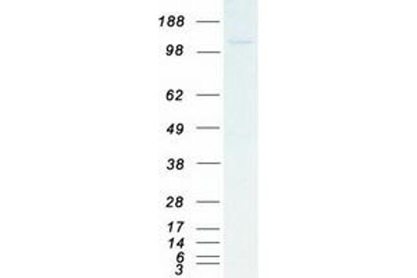 RPS6KC1 Protein (Transcript Variant 1) (Myc-DYKDDDDK Tag)