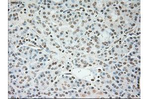 Immunohistochemical staining of paraffin-embedded pancreas tissue using anti-TNNI3mouse monoclonal antibody. (TNNI3 antibody  (AA 1-210))