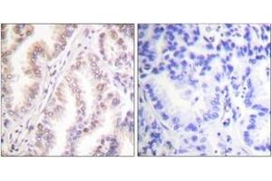 Immunohistochemistry (IHC) image for anti-Protein Inhibitor of Activated STAT, 1 (PIAS1) (AA 10-59) antibody (ABIN2889275) (PIAS1 antibody  (AA 10-59))