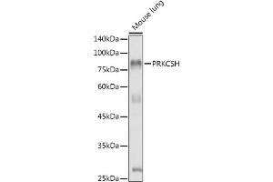 Western blot analysis of extracts of Mouse lung, using PRKCSH antibody (ABIN1682300, ABIN3018458 and ABIN7101614) at 1:1000 dilution. (PRKCSH antibody)