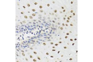 Immunohistochemistry of paraffin-embedded human esophagus using YTHDF3 antibody. (YTHDF3 antibody)