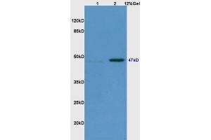 Lane 1: mouse embryo lysates Lane 2: mouse brain lysates probed with Anti Phospho-Smad3(Ser423/425) Polyclonal Antibody, Unconjugated (ABIN746138) at 1:200 in 4 °C. (SMAD3 antibody  (pSer423, pSer425))