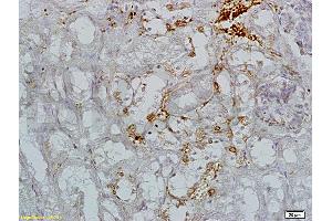 Immunohistochemistry (IHC) image for anti-Selectin L (SELL) (AA 301-372) antibody (ABIN736716)