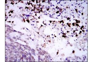 Immunohistochemistry (IHC) image for anti-Spi-B Transcription Factor (Spi-1/PU.1 Related) (SPIB) (AA 200-252) antibody (ABIN1098113)