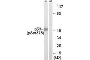 Western blot analysis of extracts from Jurkat cells treated with UV 15', using p53 (Phospho-Ser378) Antibody. (p53 antibody  (pSer378))