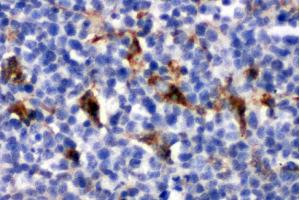 Immunohistochemistry (IHC) image for anti-CD68 Molecule (CD68) (AA 312-326), (Middle Region) antibody (ABIN3044428)