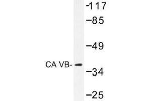 Image no. 1 for anti-Carbonic Anhydrase VB, Mitochondrial (CA5B) antibody (ABIN317824) (CA5B antibody)