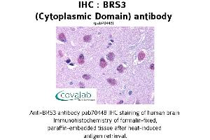 Image no. 1 for anti-Bombesin-Like Receptor 3 (BRS3) (3rd Cytoplasmic Domain) antibody (ABIN1732416) (BRS3 antibody  (3rd Cytoplasmic Domain))