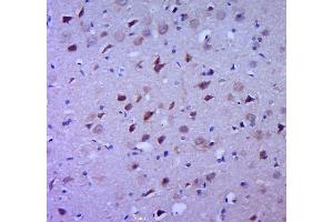 Paraformaldehyde-fixed, paraffin embedded rat brain tissue, Antigen retrieval by boiling in sodium citrate buffer (pH6. (IL-1 beta antibody  (AA 161-269))