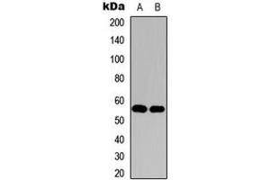 Western blot analysis of Histone Deacetylase 1 expression in HeLa (A), NIH3T3 (B) whole cell lysates. (HDAC1 antibody  (C-Term))