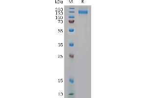 Cynomolgus NCL Protein, His Tag on SDS-PAGE under reducing condition. (Nucleolin Protein (NCL) (AA 1-711) (His tag))