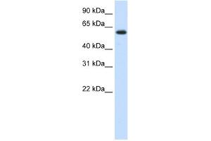 WB Suggested Anti-MGC42174 Antibody Titration:  1. (DIS3L2 antibody  (N-Term))