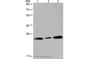 Western blot analysis of Human fetal brain tissue and 293T cell, using RAB3c Polyclonal Antibody at dilution of 1:400 (Rab3c antibody)