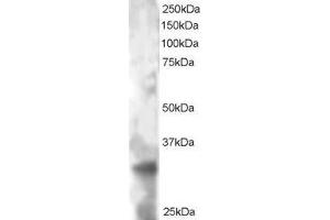 ABIN2564501 staining (2µg/ml) of HeLa lysate (RIPA buffer, 30µg total protein per lane). (TSPAN32 antibody  (C-Term))