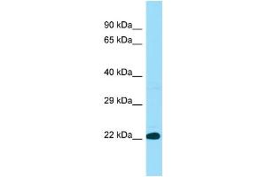 Western Blotting (WB) image for anti-Biogenesis of Lysosomal Organelles Complex-1, Subunit 3 (BLOC1S3) (N-Term) antibody (ABIN2790099) (BLOC1S3 antibody  (N-Term))