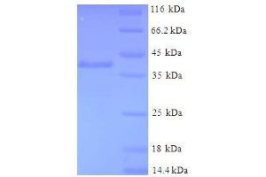 SDS-PAGE (SDS) image for Glutathione S-Transferase pi 1 (GSTP1) (AA 2-210) protein (His-SUMO Tag) (ABIN5709619) (GSTP1 Protein (AA 2-210) (His-SUMO Tag))