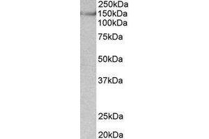 Western Blotting (WB) image for anti-Synaptic Ras GTPase Activating Protein 1 (SYNGAP1) (Internal Region) antibody (ABIN2464964) (SYNGAP1 antibody  (Internal Region))