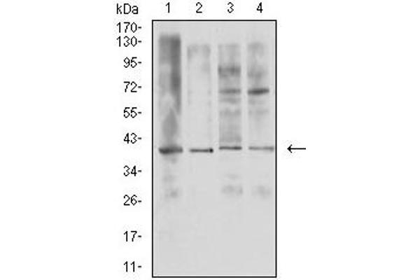 RANKL antibody  (AA 74-308)