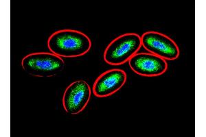 Immunocytochemistry (ICC) image for anti-Vimentin (VIM) antibody (ABIN94492)