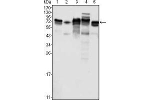 Western blot analysis using Metadherin mouse mAb against K562 (1), SKBR-3 (2), T47D (3), Hela (4) and MCF-7 (5) cell lysate. (MTDH antibody)