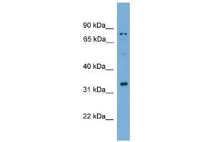 SPACA1 antibody used at 0. (SPACA1 antibody  (N-Term))