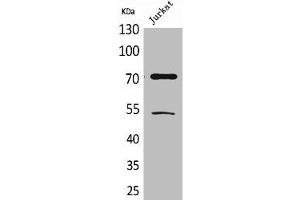 Western Blot analysis of Jurkat cells using Acetyl-Ku-70 (K539) Polyclonal Antibody (XRCC6 antibody  (acLys539))