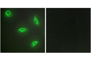 Immunofluorescence analysis of HeLa cells, using TNF14 Antibody. (TNFSF14 antibody  (AA 51-100))