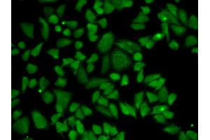 Immunofluorescence analysis of A549 cell using ALDH2 antibody. (ALDH2 antibody)