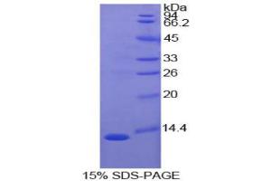 SDS-PAGE analysis of Cow S100A4 Protein. (s100a4 Protein)