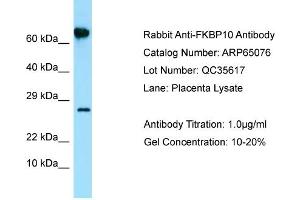 Western Blotting (WB) image for anti-FK506 Binding Protein 10, 65 KDa (FKBP10) (N-Term) antibody (ABIN970701) (FKBP10 antibody  (N-Term))