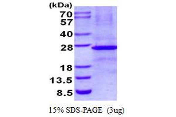 Ephrin B3 Protein (EFNB3) (His tag)