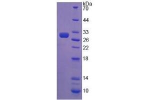 SDS-PAGE analysis of Chicken AMH Protein. (AMH Protein)