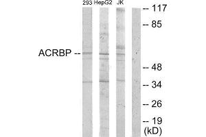 Western Blotting (WB) image for anti-Acrosin Binding Protein (ACRBP) (Internal Region) antibody (ABIN1849784) (ACRBP antibody  (Internal Region))