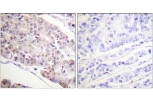 Immunohistochemistry (IHC) image for anti-Histone H4 (acLys8) antibody (ABIN2890733) (Histone H4 antibody  (acLys8))