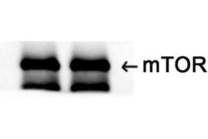 Western Blot (WB) analysis: Please contact us for more details. (MTOR antibody  (Ser394))