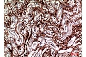 Immunohistochemical analysis of paraffin-embedded human-kidney, antibody was diluted at 1:100. (M-CSF/CSF1 antibody  (C-Term))