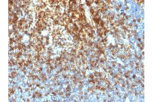 Formalin-fixed, paraffin-embedded human Tonsil stained with CD43 Rabbit Recombinant Monoclonal Antibody (SPN/1766R). (Recombinant CD43 antibody)