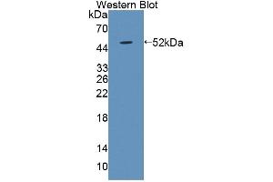 Detection of Recombinant LBP, Human using Polyclonal Antibody to Lipopolysaccharide Binding Protein (LBP) (LBP antibody  (AA 27-481))