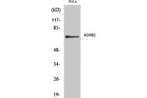 Western Blot analysis of various cells using AR-β2 Polyclonal Antibody diluted at 1:2000. (Androgen Receptor beta 2 antibody  (AA 180-260))