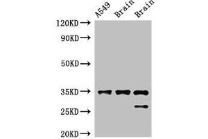 Western Blot Positive WB detected in: A549 whole cell lysate, Rat brain tissue, Mouse brain tissue All lanes: STUB1 antibody at 2 μg/mL Secondary Goat polyclonal to rabbit IgG at 1/50000 dilution Predicted band size: 35, 28 kDa Observed band size: 35, 28 kDa (STUB1 antibody  (AA 1-48))