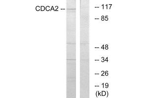 Western Blotting (WB) image for anti-Cell Division Cycle Associated 2 (CDCA2) (Internal Region) antibody (ABIN1850257) (CDCA2 antibody  (Internal Region))