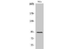 Western Blotting (WB) image for anti-Signal Transducer and Activator of Transcription 6, Interleukin-4 Induced (STAT6) (pThr645) antibody (ABIN3182154) (STAT6 antibody  (pThr645))